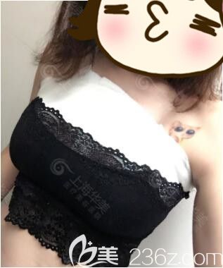 敏感自卑的你做一次娜綺麗假體隆胸后才發(fā)現(xiàn)女人挺起來更自信