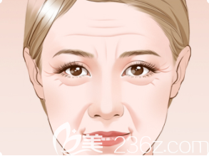 面部下垂衰老圖