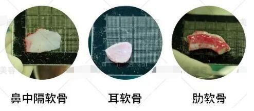 鼻綜合中常用到的自體軟骨材料分為：鼻中隔軟骨、耳軟骨、肋軟骨
