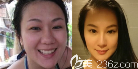 張衍爐案例 張衍爐案例