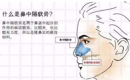什么是鼻中隔軟骨