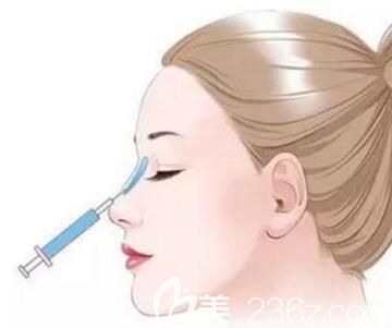 玻尿酸隆鼻會(huì)不會(huì)變形？鼻子會(huì)變寬嗎？