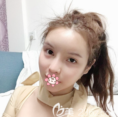 看徐威強做磨骨技術(shù)怎么樣 看徐威強做磨骨技術(shù)怎么樣