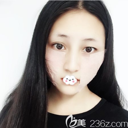 廣大醫(yī)院磨骨親身經(jīng)歷 廣大醫(yī)院磨骨親身經(jīng)歷