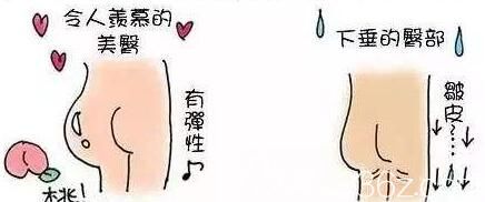 什么是自體脂肪豐臀