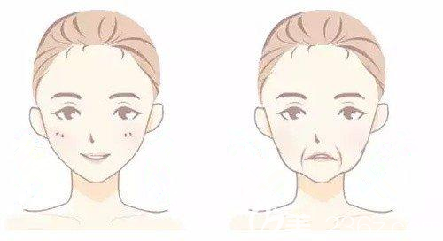 無法令紋的面部和有法令紋的面部對比