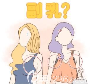 什么是副乳？