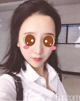 <!--<i data=20240703-sp></i>-->時光何晉龍鼻綜合真人案例術(shù)后21天 <!--<i data=20240703-sp></i>-->時光何晉龍鼻綜合真人案例術(shù)后21天