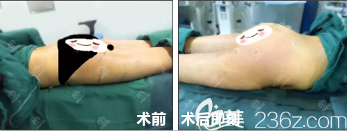 王軍主任做完手術(shù)當(dāng)時