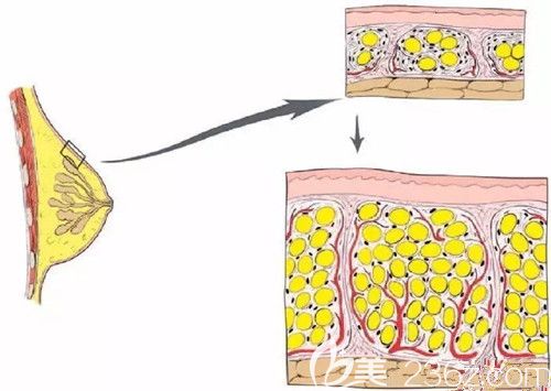 自體脂肪在體內的狀態(tài)