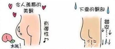 自體脂肪豐臀和假體豐臀那個好？