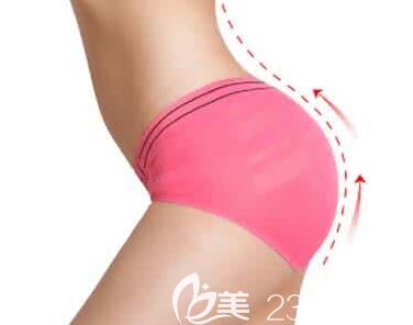 自體脂肪豐臀讓你擁有性感電臀