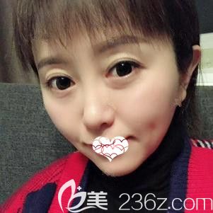 <!--<i data=20240703-sp></i>-->東院長剛為我注射玻尿酸墊下巴術(shù)后有點腫脹 <!--<i data=20240703-sp></i>-->東院長剛為我注射玻尿酸墊下巴術(shù)后有點腫脹