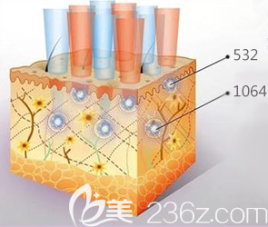 北京美萊超皮秒祛斑不同波長作用不同皮膚層示意圖 北京美萊超皮秒祛斑不同波長作用不同皮膚層示意圖