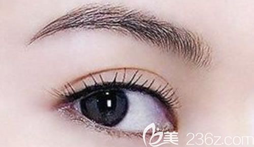 切開雙眼皮效果圖 切開雙眼皮效果圖