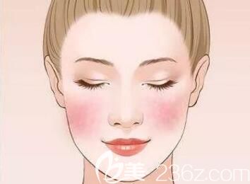 臉上紅血絲多怎么辦？祛紅血絲要多少錢？