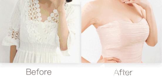 杭州美萊暑期整形季價(jià)格低到68折 隆胸醫(yī)生栗勇假體豐胸15800元起