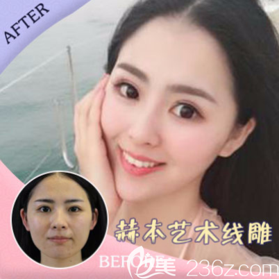 重慶美萊面部<span style= 重慶美萊面部<span style=