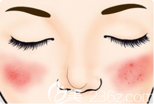 擁有紅血絲的臉