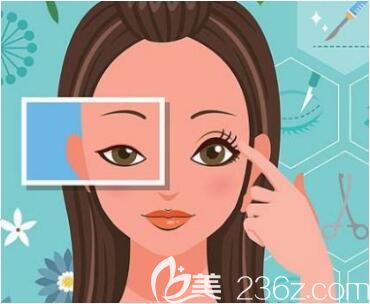 全切雙眼皮修復(fù)