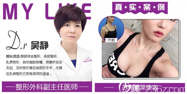 吳靜醫(yī)生自體脂肪隆胸案例 吳靜醫(yī)生自體脂肪隆胸案例