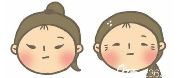 為什么下頜角截骨后臉沒小，已經(jīng)40天正面還是沒效果