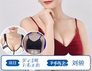 劉駿醫(yī)生做假體隆胸術(shù)后真人對(duì)比效果