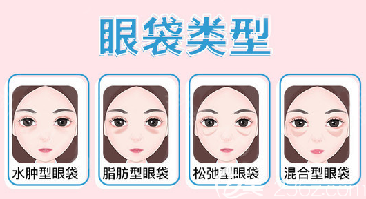 不同類型的眼袋
