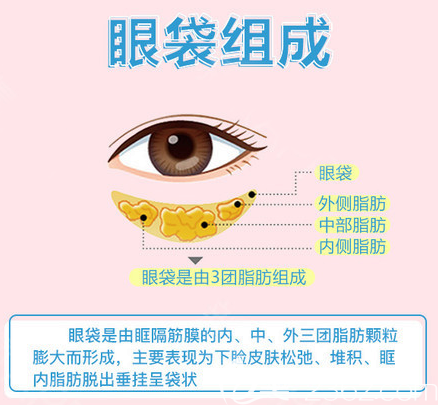 眼袋的組成部位