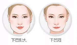 下巴寬大短