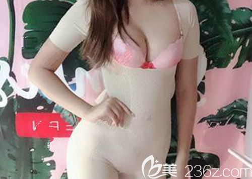 西寧時光整形王雙余給我做曼托260cc水滴形假體隆胸術后第42天 西寧時光整形王雙余給我做曼托260cc水滴形假體隆胸術后第42天