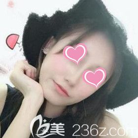 面部凹陷的我找長沙美之峰丁翔做了自體脂肪填充面部后終于重現(xiàn)少女顏！