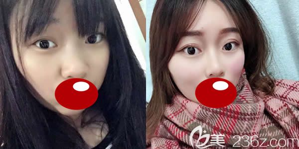 福州名韓整形察鵬飛進(jìn)口<span style=