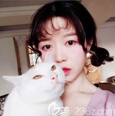 廣州廣大整形醫(yī)院隆鼻一個(gè)月<span style= 廣州廣大整形醫(yī)院隆鼻一個(gè)月<span style=