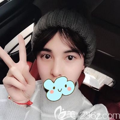 男士隆鼻效果圖來了 上傳我在洛陽找李冉醫(yī)生做的耳軟骨隆鼻過程圖