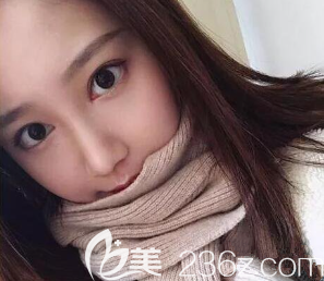 韋小勇醫(yī)生給我做完手術(shù)第十天 韋小勇醫(yī)生給我做完手術(shù)第十天