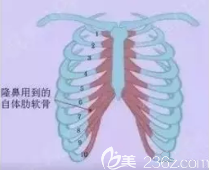 肋軟骨隆鼻取第幾肋骨