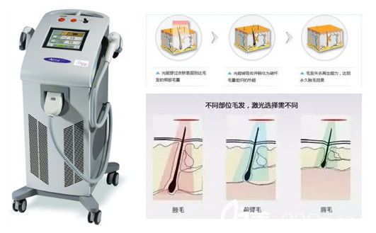 激光脫毛整形效果顯著且沒有副作用