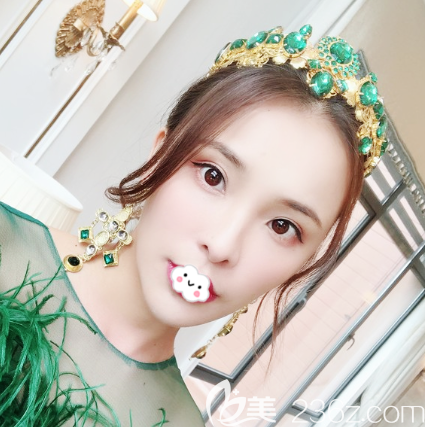 廣州曙光張小蕓玻尿酸全臉填充案例