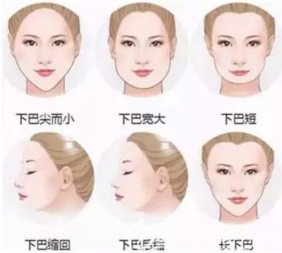 能做墊下巴整形的六種下頦類(lèi)型