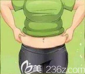 腰腹部贅肉多做腰腹吸脂后多久能消腫啊？