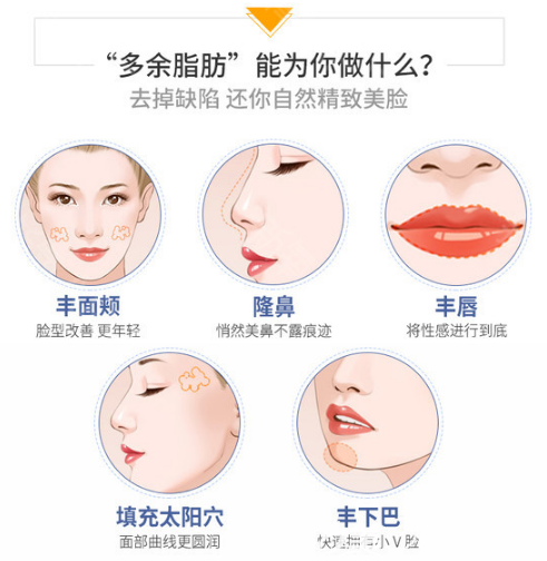 整形醫(yī)院自體脂肪填充適用范圍 整形醫(yī)院自體脂肪填充適用范圍