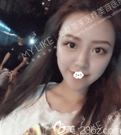 我在北京美萊做玻尿酸墊下巴第15天樣子 我在北京美萊做玻尿酸墊下巴第15天樣子