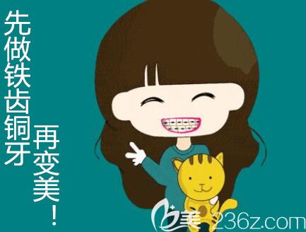 戴金屬牙套矯正虎牙