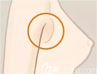 副乳的位置