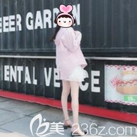 在大連新華美天做吸脂瘦大腿31天效果照