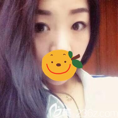 駐馬店金玄宮眼綜合術(shù)前 駐馬店金玄宮眼綜合術(shù)前