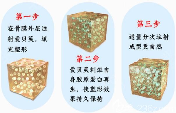 何美珍院長愛貝芙注射分享