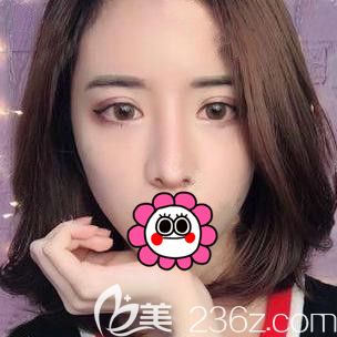 找寧波薇琳張廣巍做了耳軟骨隆鼻后我也加入了高顏值戰(zhàn)隊