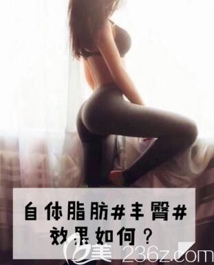 自體脂肪豐臀效果究竟如何？
